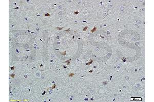 Formalin-fixed and paraffin embedded rat brain labeled with Anti PHAP1 Polyclonal Antibody, Unconjugated (ABIN762176) at 1:200 followed by conjugation to the secondary antibody and DAB staining (PHAP antibody  (AA 41-140))