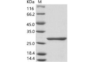 Western Blotting (WB) image for Rift Valley Fever Virus Polymerase (RVFV L) protein (His tag) (ABIN7198792)