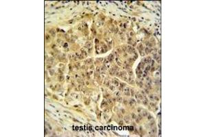 CDC45L Antibody (Center) (ABIN653837 and ABIN2843101) IHC analysis in formalin fixed and paraffin embedded testis tissue followed by peroxidase conjugation of the secondary antibody and DAB staining. (CDC45 antibody  (AA 236-263))