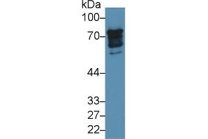 Detection of EPN1 in Human 293T cell lysate using Polyclonal Antibody to Epsin 1 (EPN1)