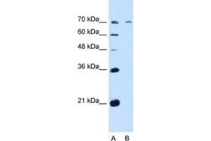 Western Blotting (WB) image for anti-UDP-N-Acetyl-alpha-D-Galactosamine:polypeptide N-Acetylgalactosaminyltransferase 6 (GalNAc-T6) (GALNT6) antibody (ABIN2463020) (GALNT6 antibody)