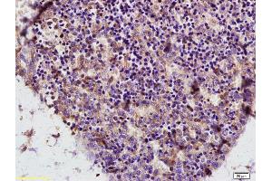 Formalin-fixed and paraffin embedded mouse embryo labeled with Anti ADA/Adenosine deaminase Polyclonal Antibody, Unconjugated (ABIN719471) at 1:200 followed by conjugation to the secondary antibody and DAB staining (ADA antibody  (AA 65-170))