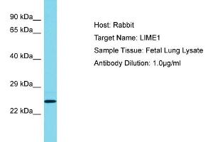 Host: Rabbit Target Name: LIME1 Sample Tissue: Human Fetal Lung Antibody Dilution: 1ug/ml (LIME antibody  (C-Term))