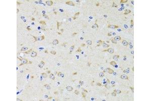 Immunohistochemistry of paraffin-embedded Rat brain using YWHAZ Polyclonal Antibody at dilution of 1:100 (40x lens). (14-3-3 zeta antibody)