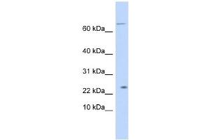 LOC441956 antibody used at 1 ug/ml to detect target protein. (LOC441956 antibody  (N-Term))