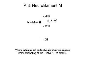 Western blot of Anti-Neurofilament M (Chicken) Antibody - 212-901-D84 Western Blot of Chicken anti-Neurofilament M antibody.