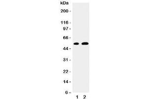 Western blot testing of EGR2 antibody and Lane 1:  mouse NIH3T3;  2: human MCF-7 cell lysate.