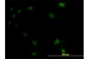 Immunofluorescence of monoclonal antibody to UBE2M on HeLa cell.