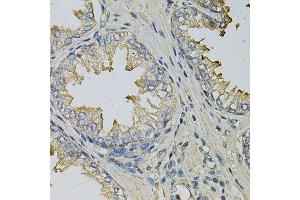 Immunohistochemistry of paraffin-embedded human prostate using LITAF Antibody. (LITAF antibody  (AA 1-161))