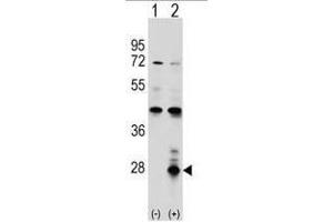 Western blot analysis of AZU1 (arrow) using rabbit polyclonal AZU1 Antibody (Center) . (Azurocidin antibody  (Middle Region))