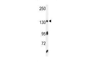 Western blot analysis of ZO1 Antibody in K562 cell line lysates (35ug/lane) (TJP1 antibody  (C-Term))