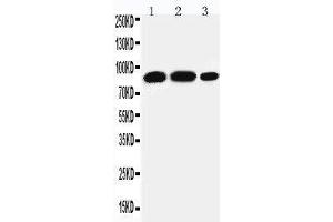Anti-STAT4 antibody, Western blotting Lane 1: Rat Testis Tissue Lysate Lane 2: U87 Cell Lysate Lane 3: HELA Cell Lysate