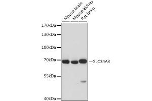 Western blot analysis of extracts of various cell lines, using SLC34 antibody (ABIN7270451) at 1:1000 dilution. (SLC34A3 antibody  (AA 210-320))