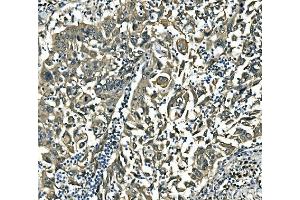 IHC analysis of EIF4A1 using anti-EIF4A1 antibody (ABIN7603125). (EIF4A1 antibody  (N-Term))
