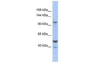 DDX58 antibody used at 1 ug/ml to detect target protein. (DDX58 antibody)