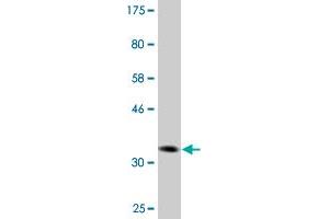 Western Blot detection against Immunogen (36. (DVL3 antibody  (AA 1-100))