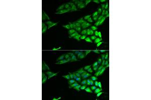 Immunofluorescence analysis of U2OS cell using PSAT1 antibody.