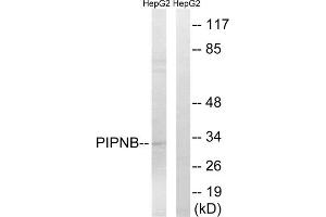 Western blot analysis of extracts from HepG2 cells, using PITPNB antibody. (PITPNB antibody  (Internal Region))