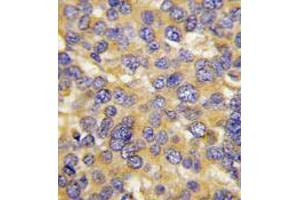 Image no. 3 for anti-DKK3 (N-Term) antibody (ABIN357071) (DKK3 antibody  (N-Term))