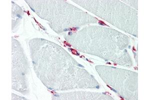 Human Skeletal Muscle: Formalin-Fixed, Paraffin-Embedded (FFPE) (CD34 antibody  (AA 366-382))