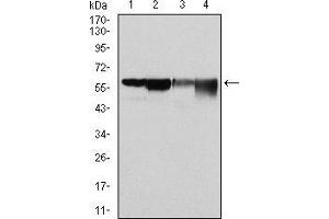 Western blot analysis using G6PD mouse mAb against Hela (1), MCF-7 (2), Jurkat (3) and K562 (4) cell lysate. (Glucose-6-Phosphate Dehydrogenase antibody)