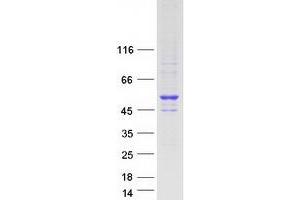 Western Blotting (WB) image for Nuclear Receptor Subfamily 2, Group E, Member 3 (NR2E3) (Transcript Variant 1) protein (Myc-DYKDDDDK Tag) (ABIN2727587)