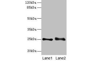 Western blot All lanes: RAB3B antibody at 4 μg/mL Lane 1: Mouse brain tissue Lane 2: U87 whole cell lysate Secondary Goat polyclonal to rabbit IgG at 1/10000 dilution Predicted band size: 25 kDa Observed band size: 25 kDa (RAB3B antibody  (AA 1-219))