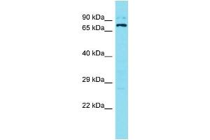 Western Blotting (WB) image for anti-Sosondowah Ankyrin Repeat Domain Family Member B (SOWAHB) (C-Term) antibody (ABIN2791404) (SOWAHB antibody  (C-Term))