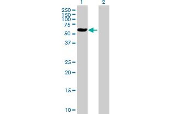 ALAD antibody  (AA 1-339)