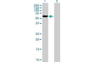 Western Blot analysis of ALAD expression in transfected 293T cell line by ALAD MaxPab polyclonal antibody. (ALAD antibody  (AA 1-339))
