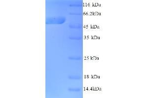SDS-PAGE (SDS) image for Kynurenine 3-Monooxygenase (Kynurenine 3-Hydroxylase) (KMO) (AA 1-486), (full length) protein (His tag) (ABIN5713590) (KMO Protein (AA 1-486, full length) (His tag))