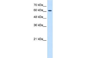 WB Suggested Anti-CHRNE Antibody Titration:  1. (CHRNE antibody  (N-Term))