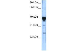 WB Suggested Anti-ZSCAN16 Antibody Titration:  0. (ZSCAN16 antibody  (C-Term))