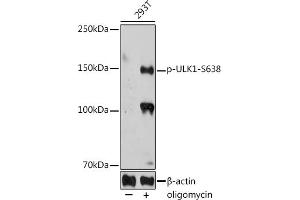 Western blot analysis of extracts of 293T cells, using Phospho-ULK1-S638 antibody (ABIN7271219) at 1:1000 dilution. (ULK1 antibody  (pSer638))