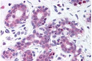 Human Breast (formalin-fixed, paraffin-embedded) stained with ESR1 antibody ABIN214159 at 1:800 followed by biotinylated anti-mouse IgG secondary antibody ABIN481714, alkaline phosphatase-streptavidin and chromogen. (ITIH1 antibody  (AA 410-592))