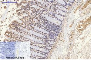 Immunohistochemical analysis of paraffin-embedded human colon tissue. (ENO2/NSE antibody)
