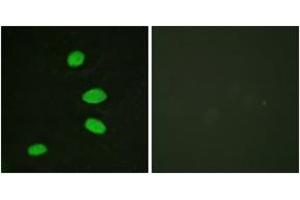 Immunofluorescence analysis of HeLa cells, using RBL2 (Ab-952) Antibody. (p130 antibody  (AA 918-967))