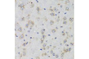 Immunohistochemistry of paraffin-embedded rat brain using ISG15 Antibody (ABIN5970528) at dilution of 1/100 (40x lens). (ISG15 antibody)
