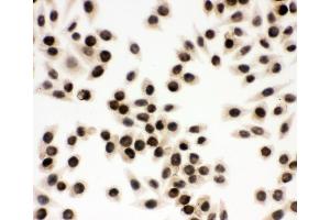 anti-Ewing Sarcoma Breakpoint Region 1 (EWSR1) (AA 369-399), (Middle Region) antibody