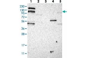 Western blot analysis of Lane 1: RT-4, Lane 2: U-251 MG, Lane 3: Human Plasma, Lane 4: Liver, Lane 5: Tonsil with ARHGEF10L polyclonal antibody . (ARHGEF10L antibody)