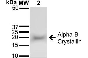 Western blot analysis of Rat Brain cell lysates showing detection of ~22 kDa Alpha B Crystallin protein using Rabbit Anti-Alpha B Crystallin Polyclonal Antibody (ABIN361836 and ABIN361837).
