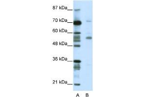 WB Suggested Anti-CORO1A Antibody Titration:  2. (Coronin 1a antibody  (N-Term))
