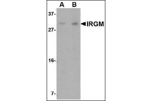 Western blot analysis of IRGM in Rat brain lysate with this product at (A) 1 and (B) 2 μg/ml. (IRGM antibody  (N-Term))