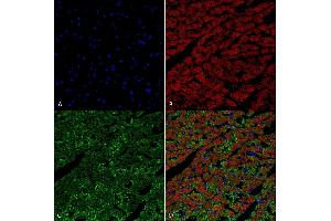 Immunohistochemistry analysis using Mouse Anti-Hexanoyl-Lysine adduct Monoclonal Antibody, Clone 5D9 (ABIN5067251). (Hexanoyl-Lysine Adduct (HEL) antibody (PE))