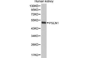 Western Blotting (WB) image for anti-Presenilin 1 (PSEN1) (AA 1-160) antibody (ABIN6219418) (Presenilin 1 antibody  (AA 1-160))