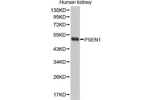 Presenilin 1 antibody  (AA 1-160)