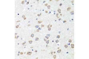 Immunohistochemistry of paraffin-embedded mouse brain using CHD1 antibody at dilution of 1:100 (x40 lens).
