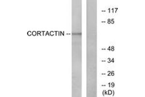 Western blot analysis of extracts from HeLa cells, treated with H2O2, using Cortactin (Ab-421) Antibody.