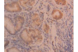 IHC-P analysis of Human Stomach Tissue, with DAB staining. (ANGPTL2 antibody  (AA 267-493))