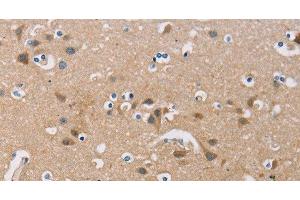 Immunohistochemistry of paraffin-embedded Human brain using FXYD1 Polyclonal Antibody at dilution of 1:60 (FXYD1 antibody)